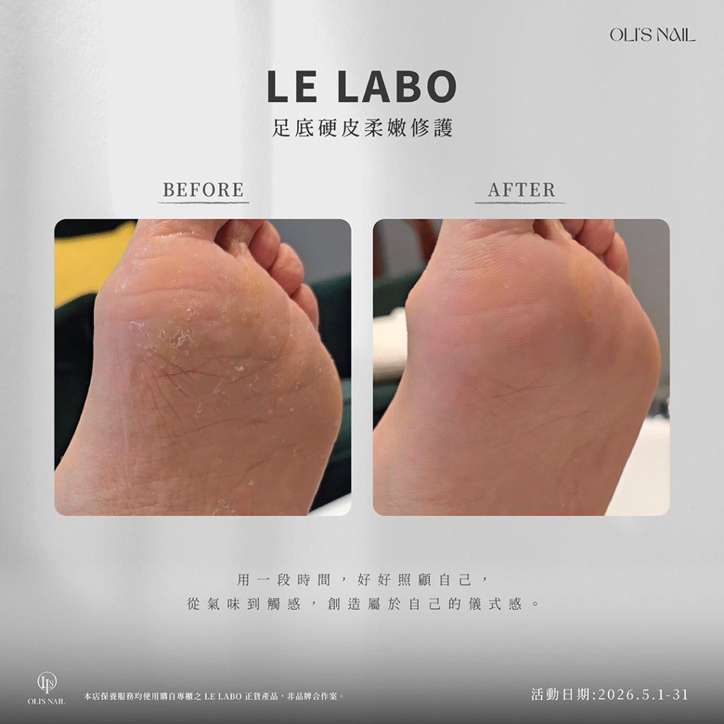 足底硬皮修護保養｜改善腳底粗糙乾裂｜恢復柔嫩細緻足部肌膚、足底硬皮深層修護｜改善乾裂粗厚角質｜打造柔嫩光滑足部、足底硬皮細緻修護保養｜溫和去除老廢角質｜提升整體足部質感、專業足底硬皮修護課程｜深層保養改善乾燥粗糙｜打造細嫩足部狀態
